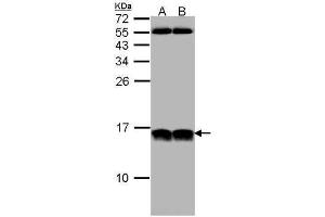 Image no. 3 for anti-NHP2 Non-Histone Chromosome Protein 2-Like 1 (NHP2L1) (full length) antibody (ABIN2856662)