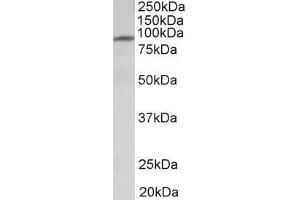 Image no. 1 for anti-Major Facilitator Superfamily Domain Containing 6 (MFSD6) (Internal Region) antibody (ABIN987283)