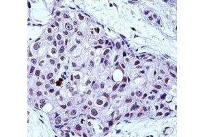 Image no. 1 for anti-V-Myb Myeloblastosis Viral Oncogene Homolog (Avian) (MYB) (AA 419-448) antibody (ABIN3029529)