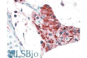 Image no. 1 for anti-T-Cell Lymphoma Invasion and Metastasis 2 (TIAM2) (N-Term) antibody (ABIN768631)