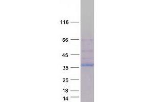 Image no. 1 for NIMA (Never in Mitosis Gene A)-Related Kinase 6 (NEK6) (Transcript Variant 5) protein (Myc-DYKDDDDK Tag) (ABIN2727083)