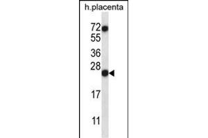 RNASE8 抗体  (C-Term)