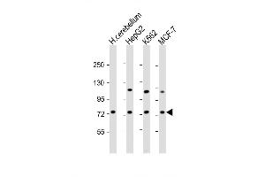 Image no. 2 for anti-Sphingomyelin phosphodiesterase 1, Acid Lysosomal (SMPD1) (AA 391-419), (C-Term) antibody (ABIN5536932)