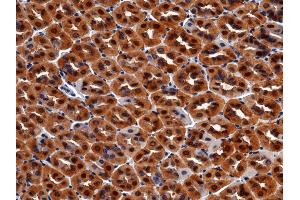 Image no. 4 for anti-Carbonic Anhydrase II (CA2) (AA 1-260) antibody (ABIN2001315)