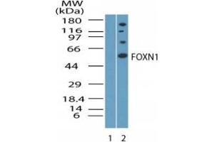 Image no. 1 for anti-Forkhead Box N1 (FOXN1) (AA 450-500) antibody (ABIN232163)