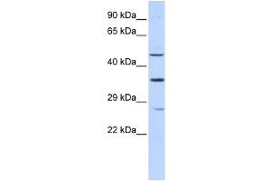 Image no. 1 for anti-Myocyte Enhancer Factor 2B (MEF2B) (N-Term) antibody (ABIN2780723)
