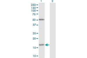 Western Blot analysis of FUT2 expression in transfected 293T cell line by FUT2 monoclonal antibody (M02), clone 4C12.