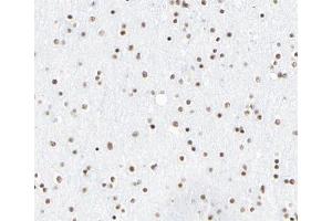 Image no. 3 for anti-Clock Homolog (Mouse) (CLOCK) antibody (ABIN6260894)