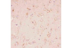 Image no. 7 for anti-Tuberous Sclerosis 2 (TSC2) (AA 1611-1807) antibody (ABIN3043498)