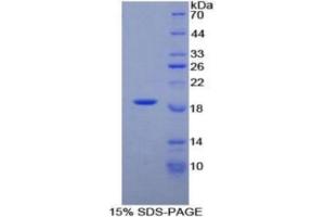Image no. 5 for Phospholipase A2-Activating Protein (PLAA) ELISA Kit (ABIN6730908)