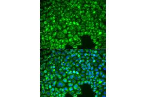 Image no. 4 for anti-Nuclear Factor of kappa Light Polypeptide Gene Enhancer in B-Cells Inhibitor, alpha (NFKBIA) antibody (ABIN3021668)