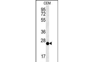 CRISPLD2 antibody  (N-Term)