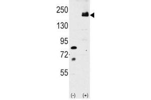 Image no. 1 for anti-Low Density Lipoprotein Receptor-Related Protein 6 (LRP6) (AA 1531-1560) antibody (ABIN3028807)