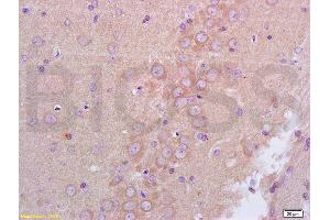 Formalin-fixed and paraffin embedded rat brain tissue labeled with Anti-GABRA1 Polyclonal Antibody, Unconjugated (ABIN673734) at 1:200 followed by conjugation to the secondary antibody and DAB staining