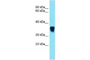Image no. 1 for anti-Sorting Nexin 15 (SNX15) (C-Term) antibody (ABIN2790378)