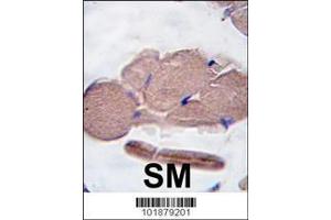 Image no. 2 for anti-Myostatin (MSTN) (AA 9-38), (N-Term) antibody (ABIN388821)