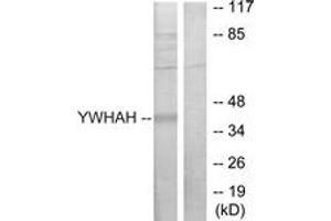 Image no. 1 for anti-14-3-3 eta (YWHAH) (AA 51-100) antibody (ABIN1534234)