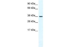 TRPM3 antibody  (N-Term)