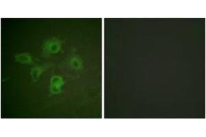 Immunofluorescence analysis of HuvEc cells, using EPHB1/2 (Phospho-Tyr594/604) Antibody.