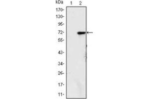 anti-Lysine (K)-Specific Demethylase 4A (KDM4A) antibody