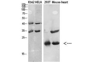 Image no. 2 for anti-Chemokine (C-C Motif) Ligand 27 (CCL27) antibody (ABIN3181745)