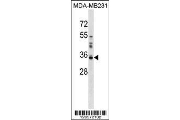 anti-Lectin, Galactoside-Binding, Soluble, 8 (LGALS8) (AA 271-298), (C-Term) antibody