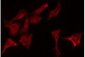 Image no. 4 for anti-COP9 Signalosome Complex Subunit 3 (COPS3) (C-Term) antibody (ABIN6260969)