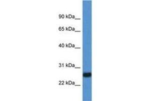 Image no. 1 for anti-Interleukin 27 (IL27) (C-Term) antibody (ABIN6749775)