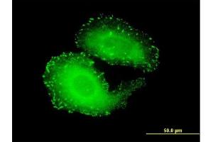 Immunofluorescence of monoclonal antibody to TNS4 on HeLa cell.