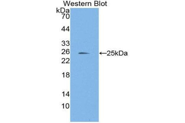 Laminin alpha 1 antibody  (AA 41-230)