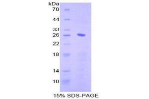 Image no. 1 for CD79b Molecule, Immunoglobulin-Associated beta (CD79B) (AA 37-226) protein (His tag,T7 tag) (ABIN1879155)