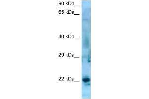 Image no. 2 for anti-Synovial Sarcoma, X Breakpoint 5 (SSX5) (C-Term) antibody (ABIN2781136)