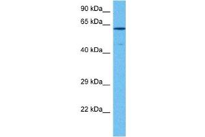 Image no. 7 for anti-SRY (Sex Determining Region Y)-Box 10 (SOX10) (Middle Region) antibody (ABIN2777864)