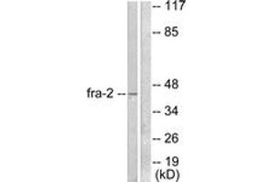 Image no. 1 for anti-FOS-Like Antigen 2 (FOSL2) (AA 271-320) antibody (ABIN1533278)