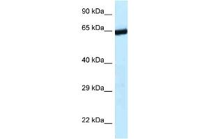 Image no. 1 for anti-Excision Repair Cross-Complementing Rodent Repair Deficiency, Complementation Group 6-Like 2 (ERCC6L2) (C-Term) antibody (ABIN2775245)