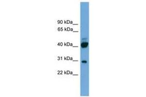 Image no. 1 for anti-Proline Rich 5 (Renal) (PRR5) (AA 35-84) antibody (ABIN6746469)