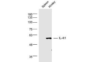 anti-Interleukin 4 Induced 1 (IL4I1) (AA 51-160) antibody
