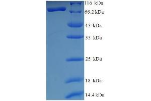 Image no. 1 for Histone Deacetylase 1 (HDAC1) (AA 1-482), (full length) protein (His-SUMO Tag) (ABIN5709649)