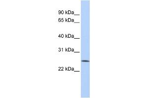 Image no. 1 for anti-F-Box Protein 22 (FBXO22) (Middle Region) antibody (ABIN2774089)
