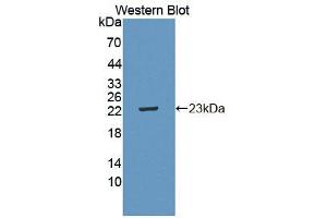 Image no. 1 for anti-Interleukin 21 Receptor (IL21R) (AA 23-185) antibody (ABIN1868630)