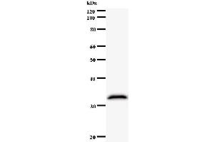 Image no. 1 for anti-Nuclear Receptor Subfamily 2, Group C, Member 1 (NR2C1) antibody (ABIN932468)