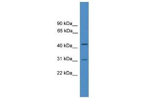 Image no. 2 for anti-OTU Domain Containing 6A (OTUD6A) (Middle Region) antibody (ABIN2788002)