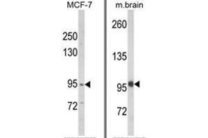Image no. 1 for anti-Vacuolar Protein Sorting 53 Homolog (VPS53) (N-Term) antibody (ABIN453870)