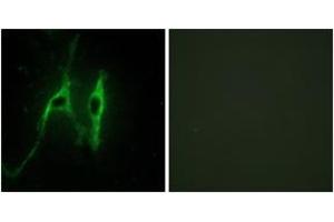 Image no. 2 for anti-Cytochrome b5 (CYTB5) (AA 61-110) antibody (ABIN1534433)