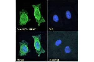 anti-Protein tyrosine Phosphatase, Non-Receptor Type 11 (PTPN11) (C-Term) antibody
