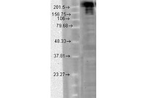 Image no. 2 for anti-Sodium Channel, Voltage-Gated, Type IX, alpha Subunit (SCN9A) (AA 1751-1946) antibody (ABIN361773)
