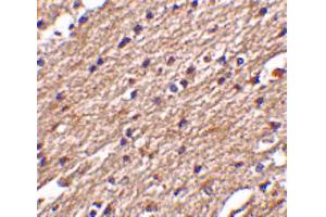 Image no. 2 for anti-Sprouty-Related, EVH1 Domain Containing 3 (SPRED3) (Internal Region) antibody (ABIN6655263)