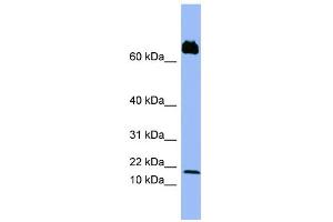 Image no. 1 for anti-Platelet Factor 4 Variant 1 (PF4V1) (Middle Region) antibody (ABIN2777124)