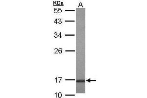 anti-Ubiquitin-Conjugating Enzyme E2A (ube2a) (full length) antibody