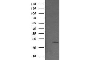 Image no. 2 for anti-NADH Dehydrogenase (Ubiquinone) 1 beta Subcomplex, 9, 22kDa (NDUFB9) (AA 3-179) antibody (ABIN1491359)
